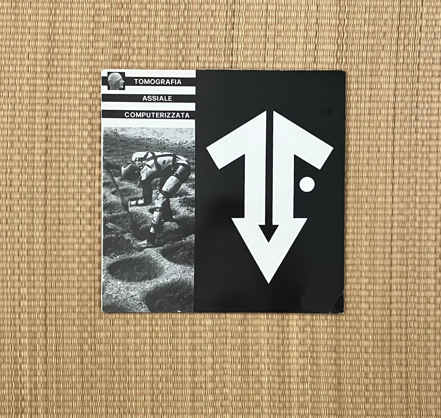 tomografia assiale computerizzata - s/t
